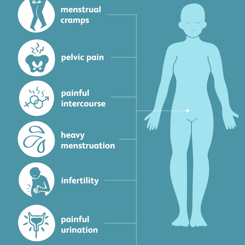 Uterine pain between periods sales