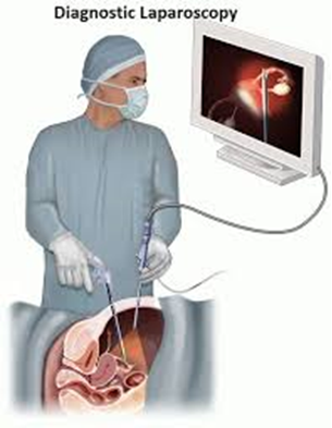 لاپاروسکوپی تشخیصی1