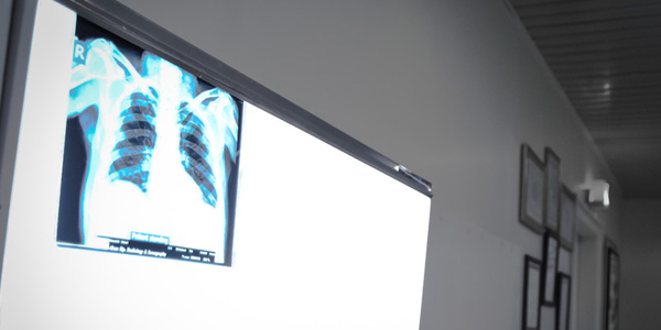 تقويم العظام