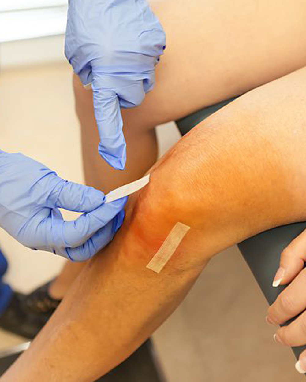 آرتروسکوپی6